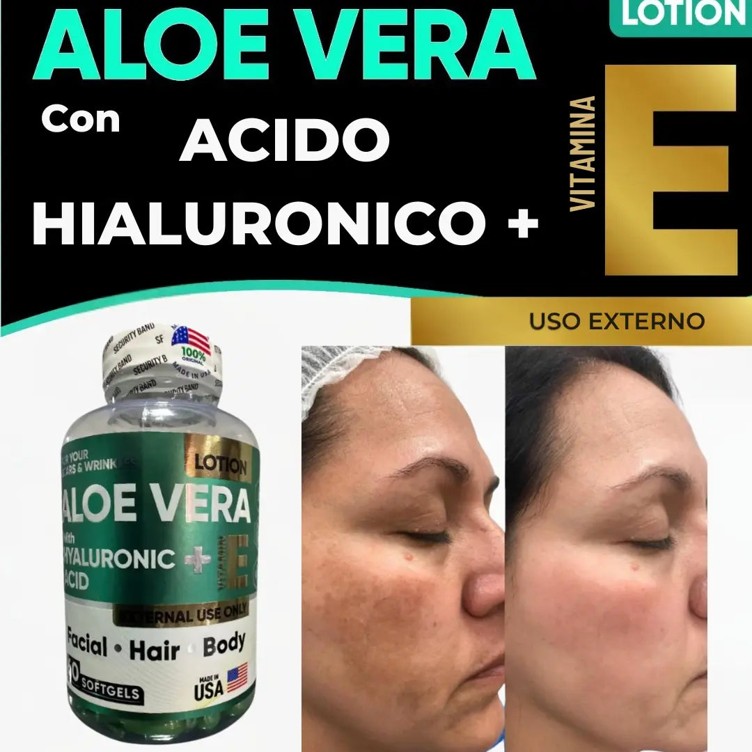Aloe Vera + Acido Hialurónico + Vitamina E - ELYVIA