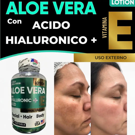 Aloe Vera + Acido Hialuronico + Vitamina E - ELYVIA